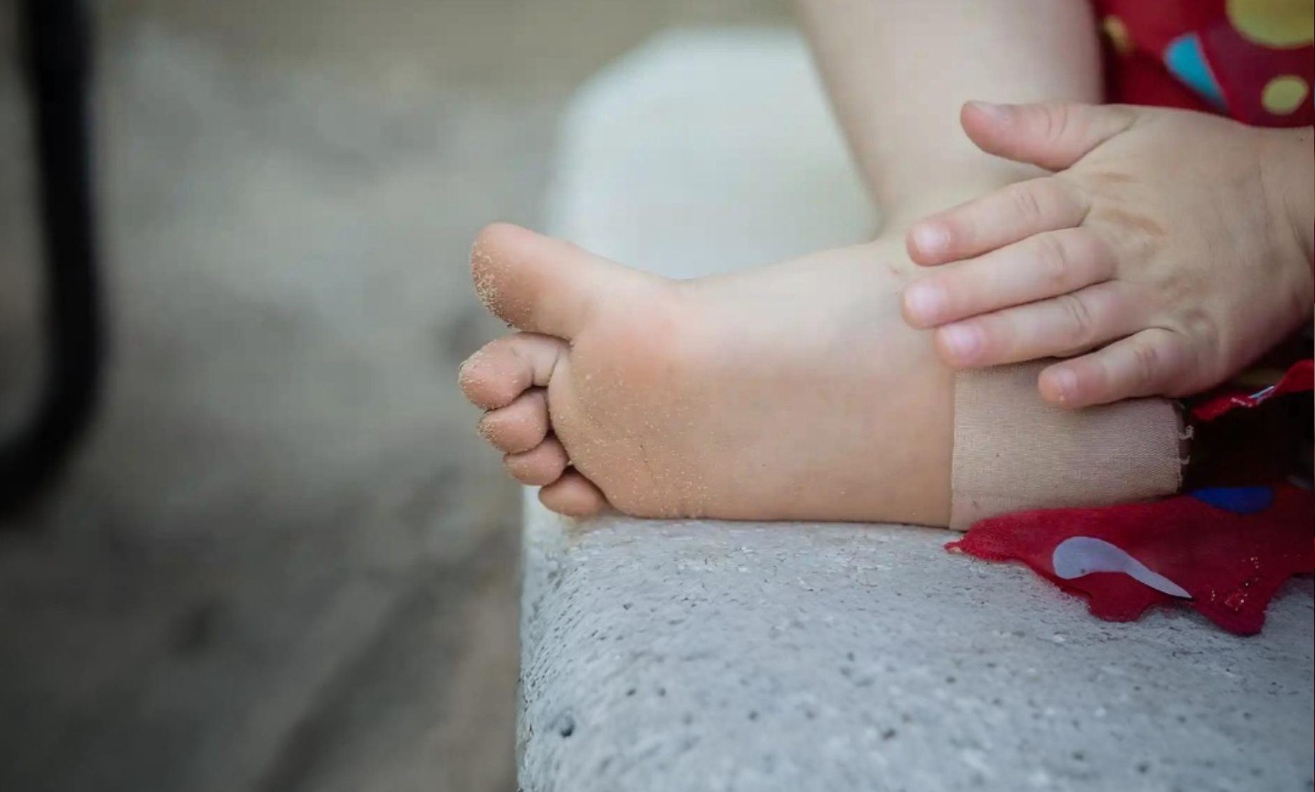 FACA - Heel pain in children2