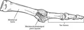 Capsulitis of the Second Toe pic structure