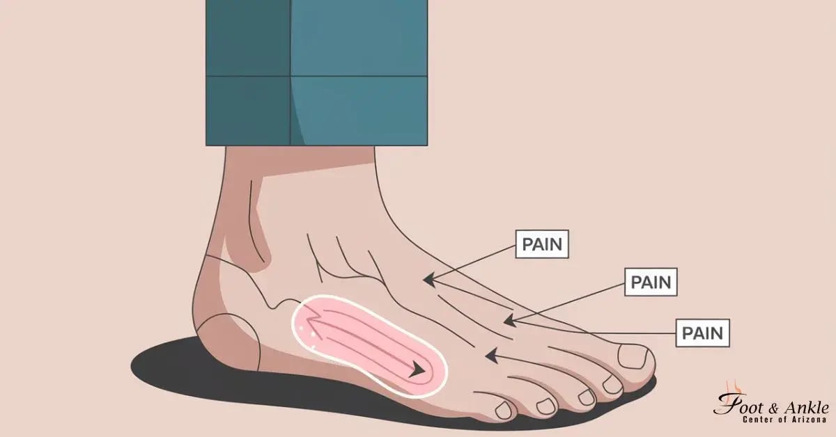 Foot Pain on the Outside