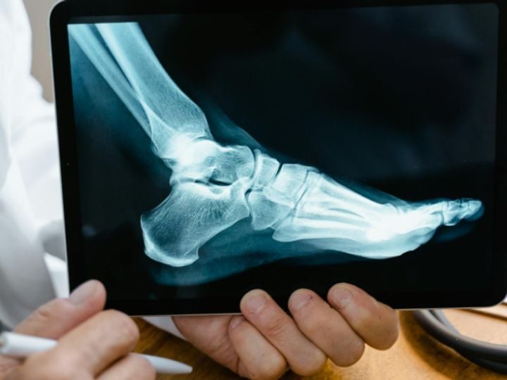 Orthopaedics and Rehab