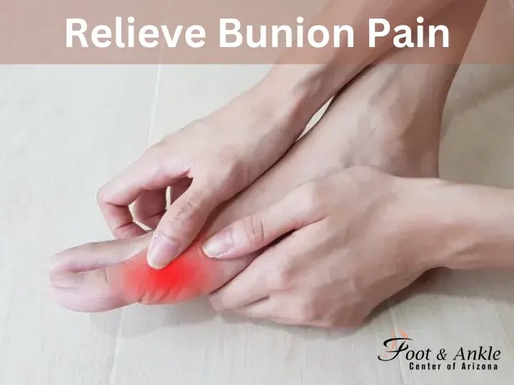 Relieve Bunion Pain