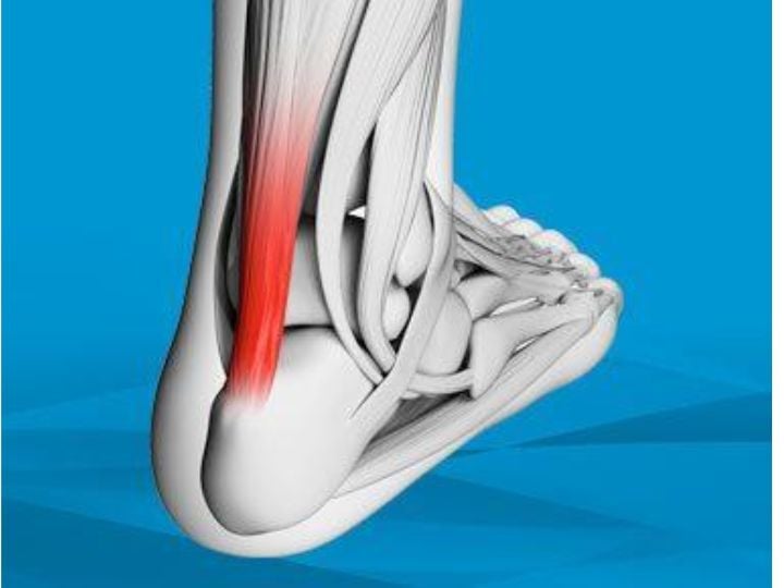 What do the Achilles tendons do?