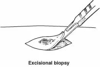 Soft-Tissue Biopsy