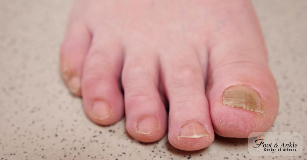 Women's Feet Hurt More in Autumn