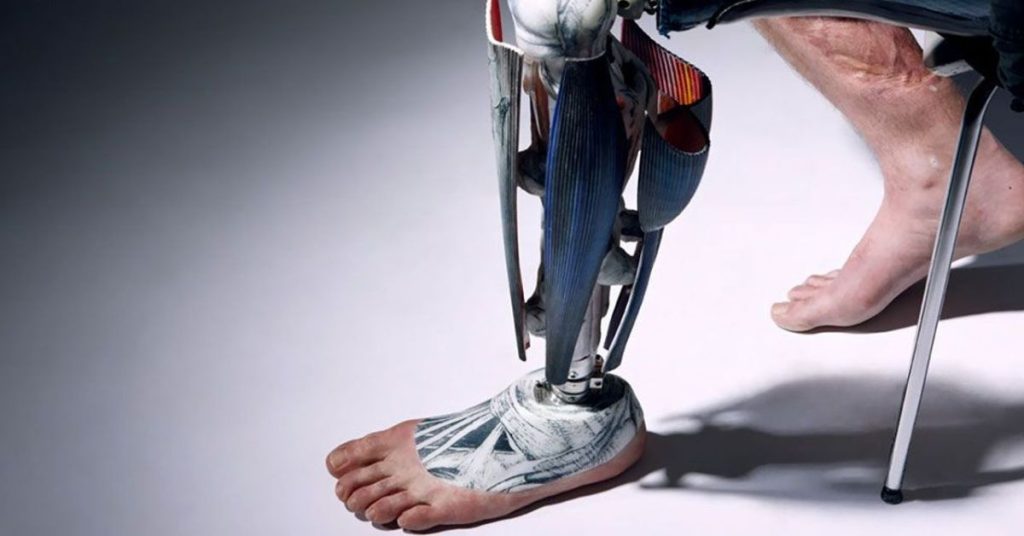 Future of Prosthetic Limbs