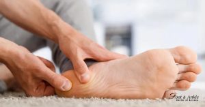 plantar fasciitis