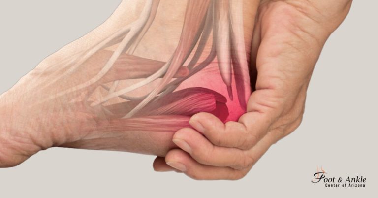 Heel Pain