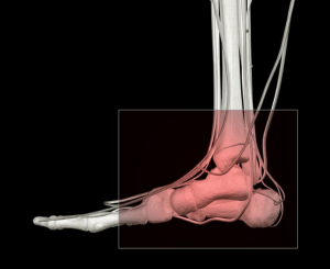 Heel Injuries treatment 