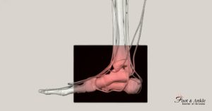 The Benefits of Treatment for Common Heel Injuries