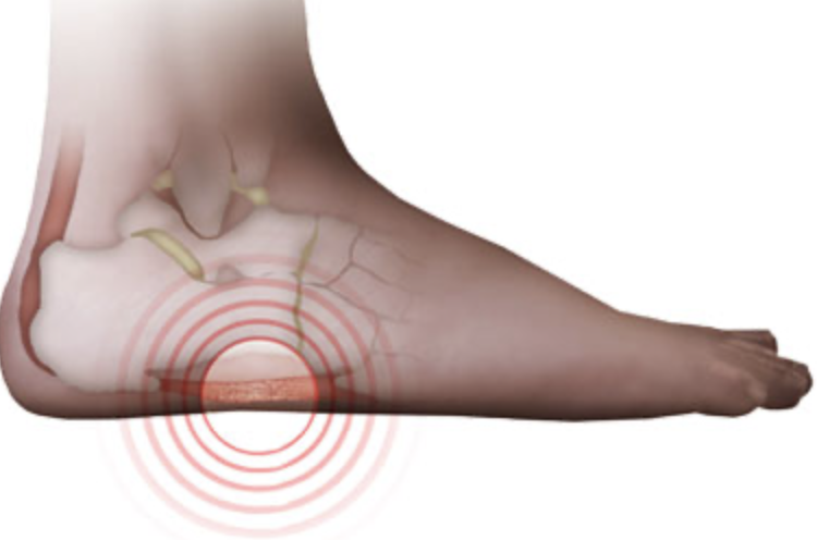 outside foot pain