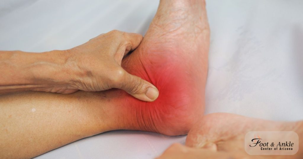 Find Relief from Ankle Arthritis