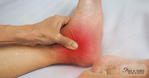 Treatment for Ankle Arthritis