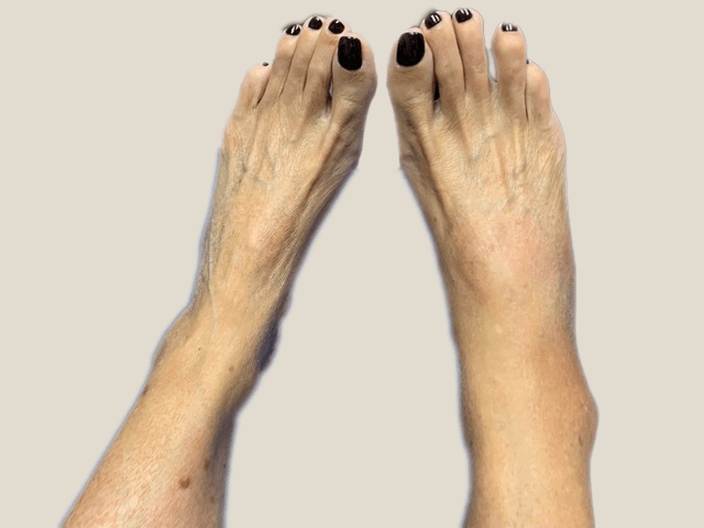 foot and nails