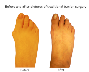 before and after 1