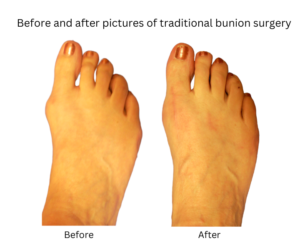 before and after 4