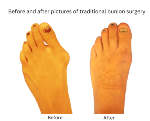 before and after 5