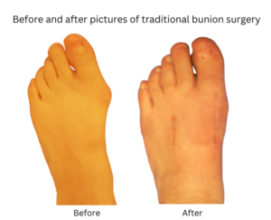 before and after 6