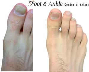 before and after 3