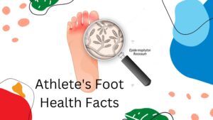 Athletes-Foot
