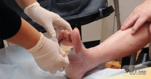 duloxetine medscape
