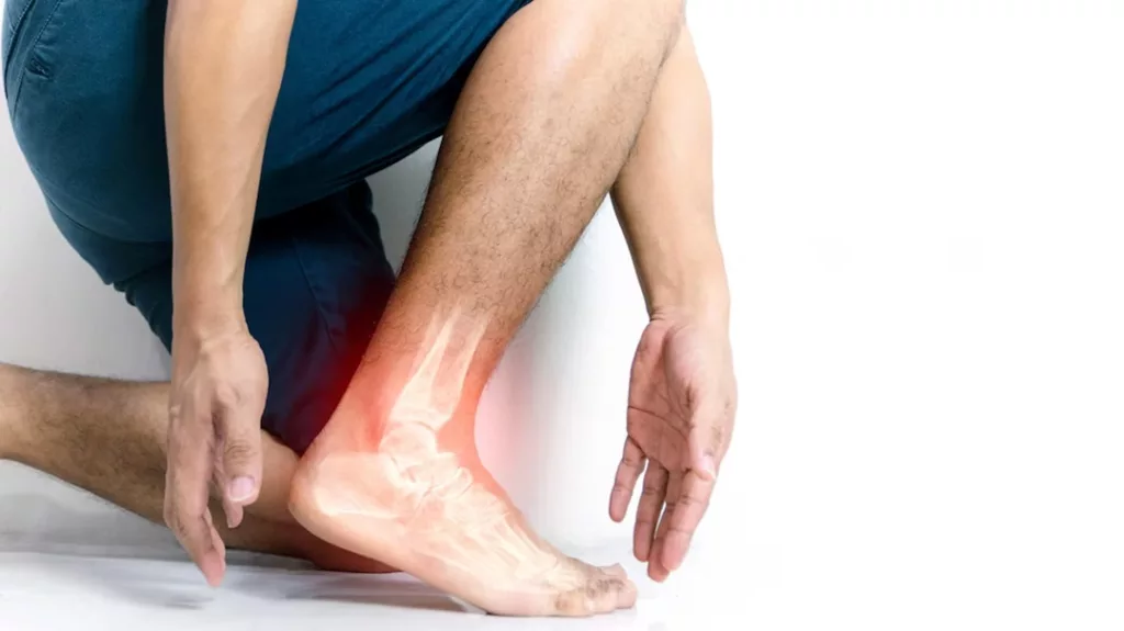 Arthritis in Ankles