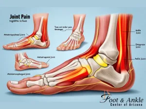 Foot Joint Pain