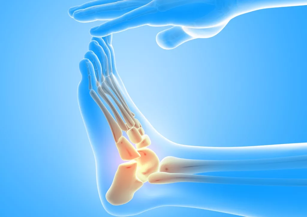 Lisfranc Joint Injuries