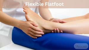 flexible flatfoot
