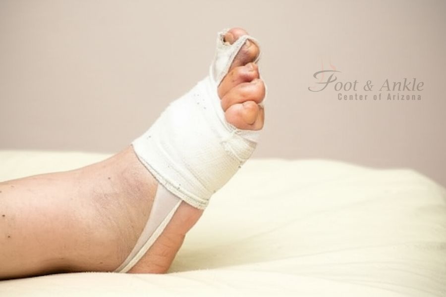 Puncture Wounds