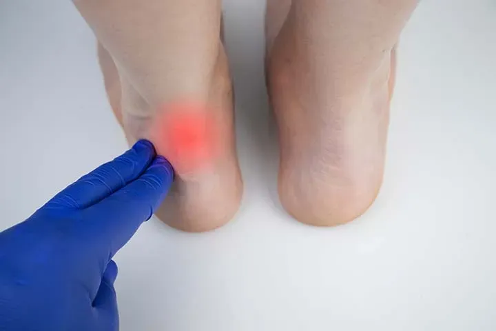 Achilles Tendon Injuries