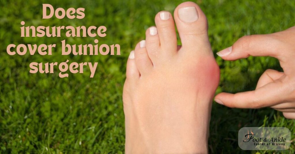 Does insurance cover bunion surgery