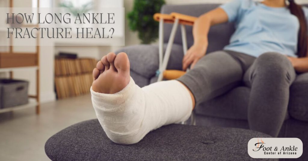 How Long Ankle Fracture Heal