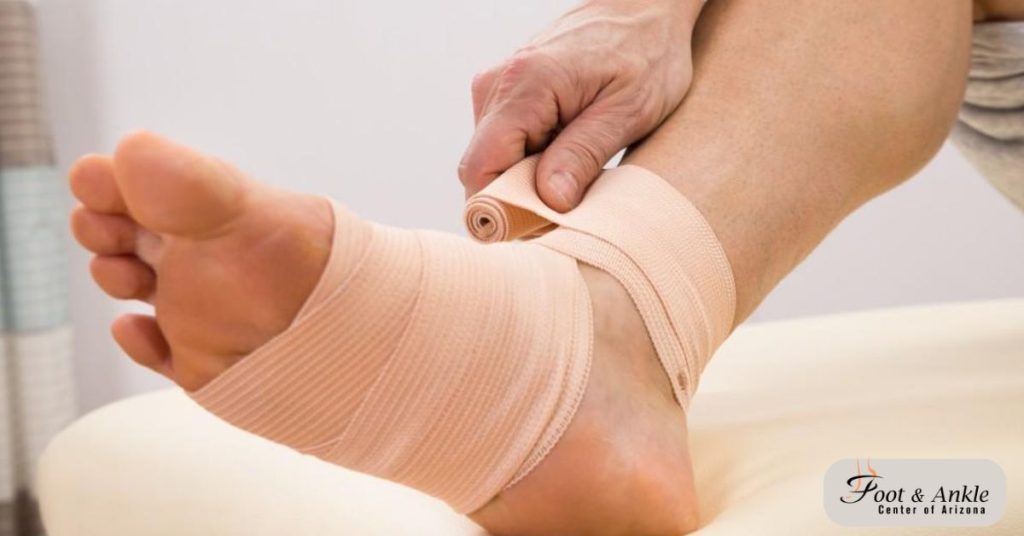 ankle fracture recovery