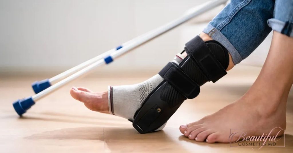 How to Heal Ligaments Faster in Ankle