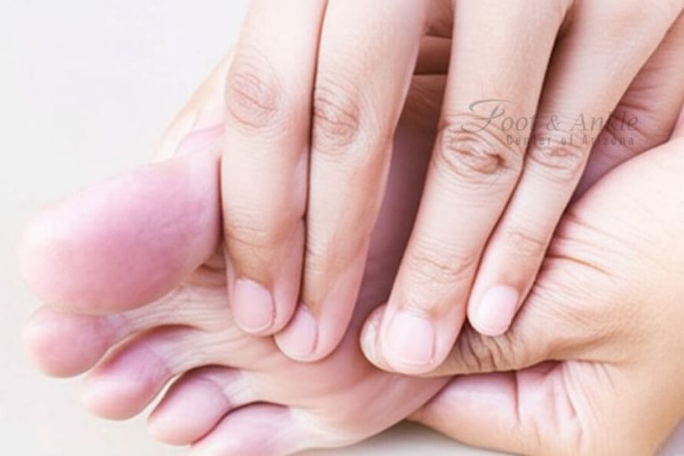 Metatarsalgia vs Morton's Neuroma