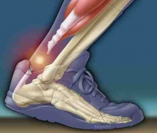 Common lower injuries