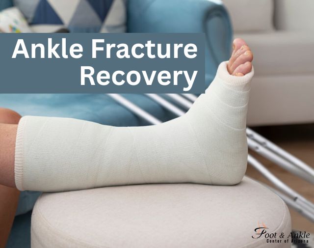Ankle Fracture Recovery