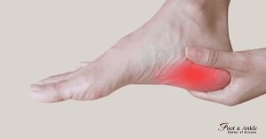 What Causes Plantar Fasciitis