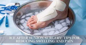 Ice After Bunion Surgery