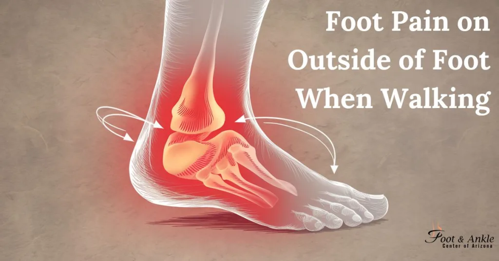 Foot Pain on Outside of Foot When Walking