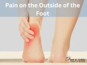 Pain on the outside of the foot