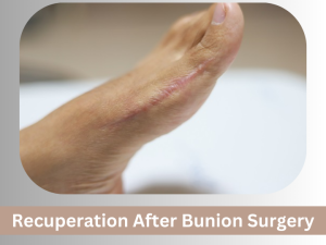 Recuperation After Bunion Surgery