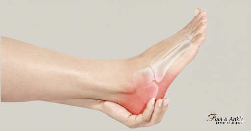 Heel pain relief
