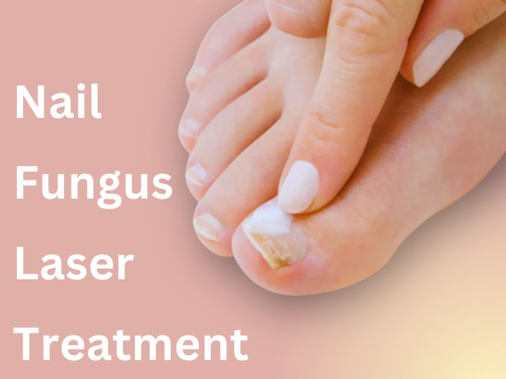 Toenail Fungus Acrylic Nails