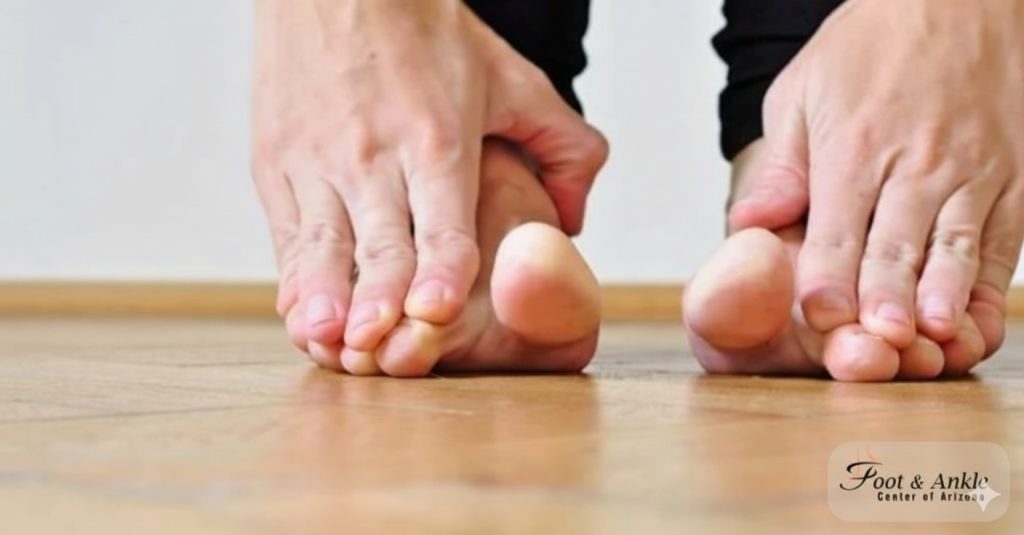 Common Foot Conditions