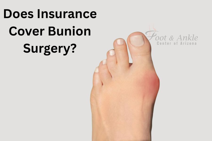 Does insurance cover bunion surgery