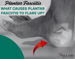 [2025] What Causes Plantar Fasciitis to Flare up?