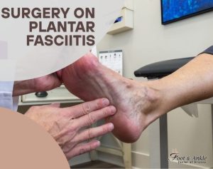 Surgery on Plantar Fasciitis