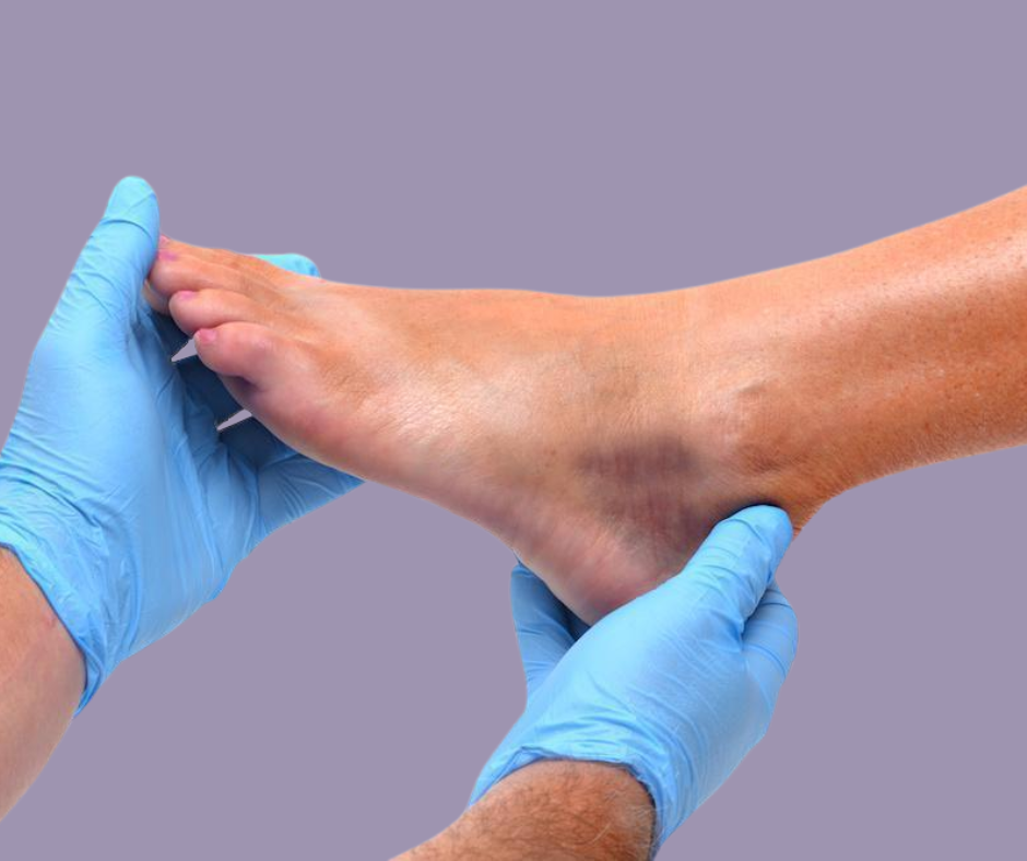 Achilles Tendon Surgery