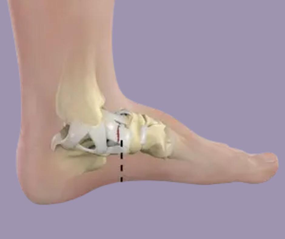 Lateral Ankle Ligaments